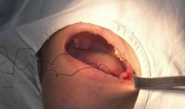 智齿完整版在线观看,揭秘青春成长的秘密与挑战